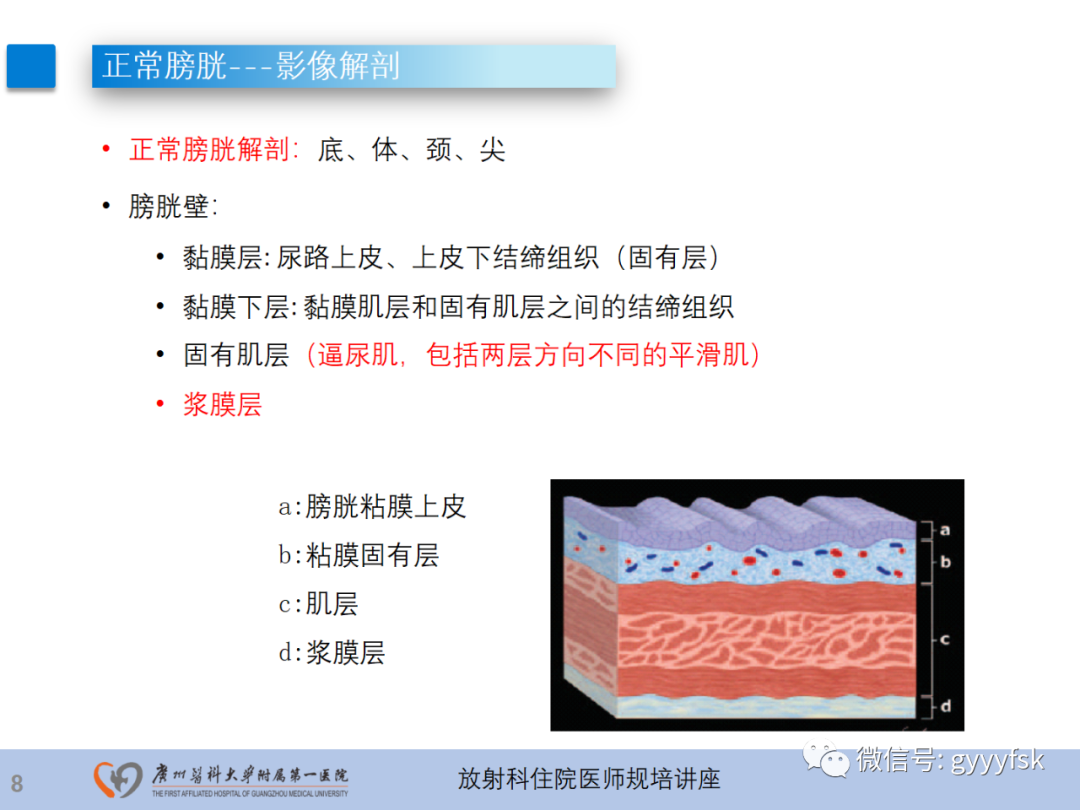 影像PPT - 【PPT】膀胱癌影像诊断、分期及鉴别诊断-9