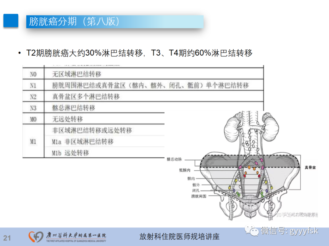 影像PPT - 【PPT】膀胱癌影像诊断、分期及鉴别诊断-22