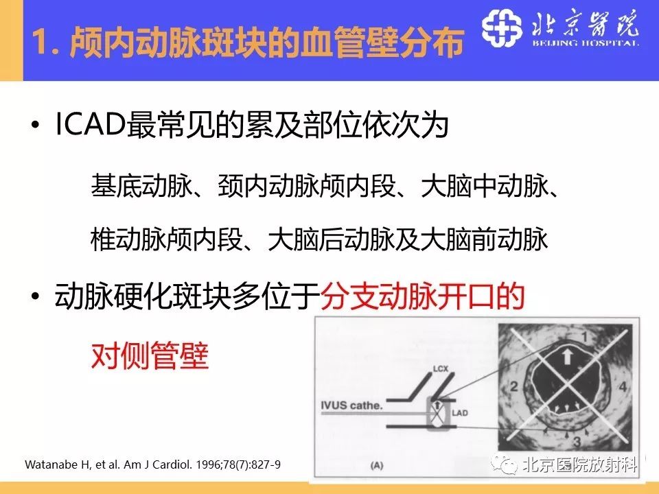 影像PPT - 【PPT】HRMRI在缺血性脑卒中精准病因诊断中的应用-21