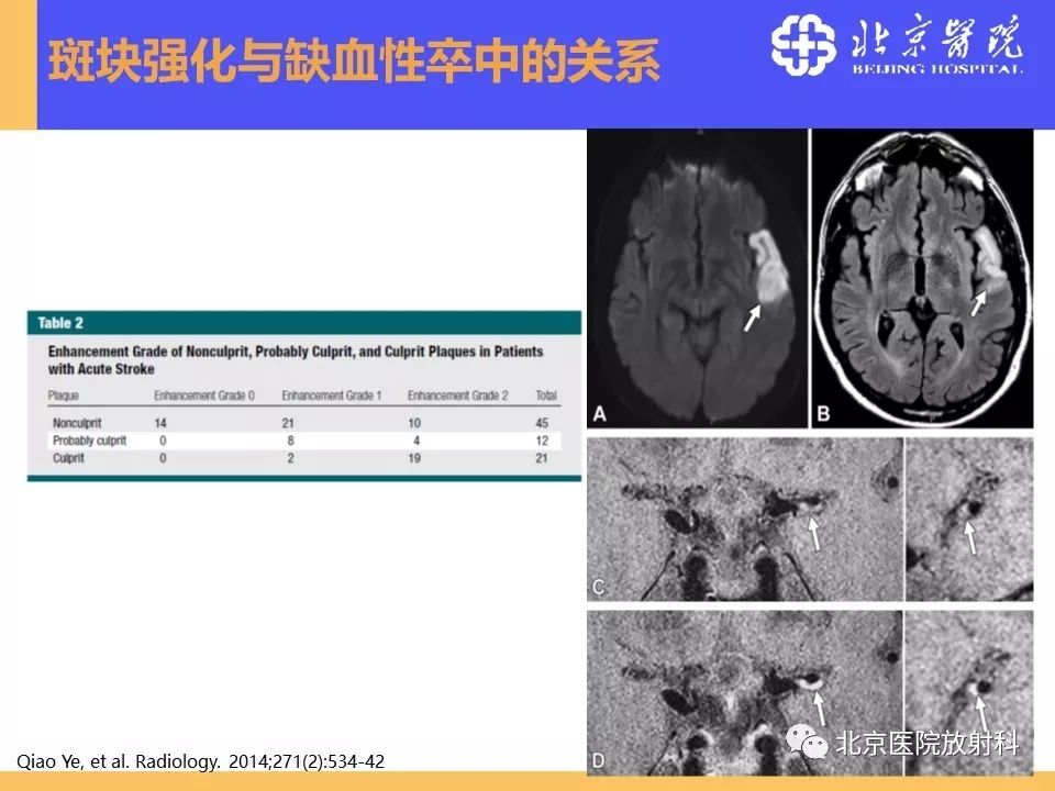 影像PPT - 【PPT】HRMRI在缺血性脑卒中精准病因诊断中的应用-41
