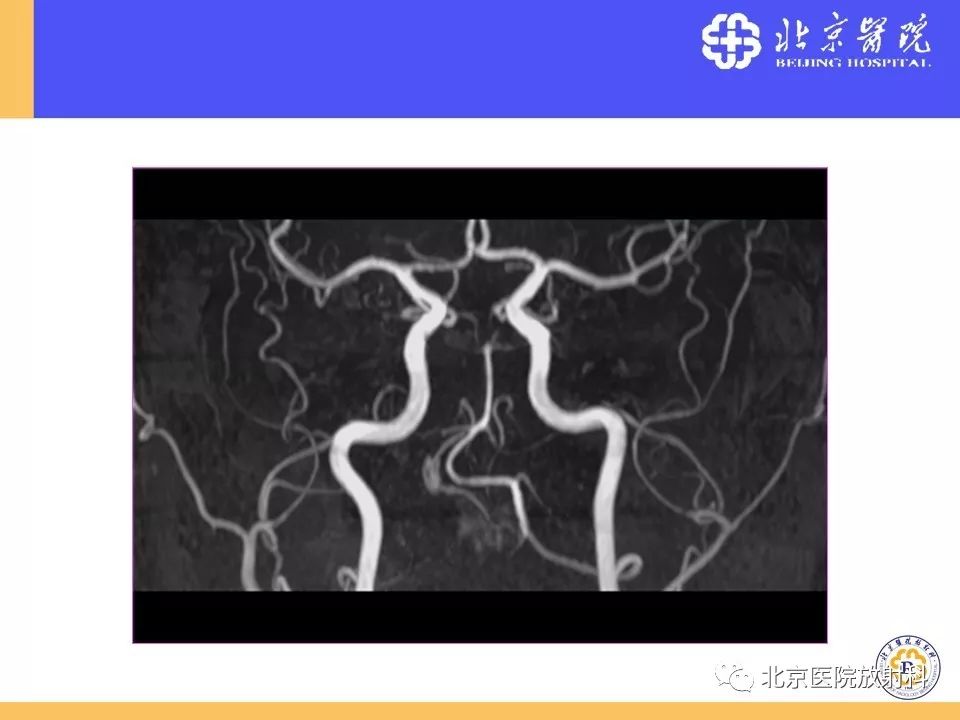 影像PPT - 【PPT】HRMRI在缺血性脑卒中精准病因诊断中的应用-74