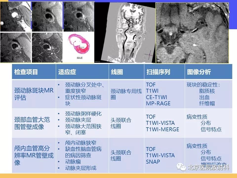 影像PPT - 【PPT】HRMRI在缺血性脑卒中精准病因诊断中的应用-78