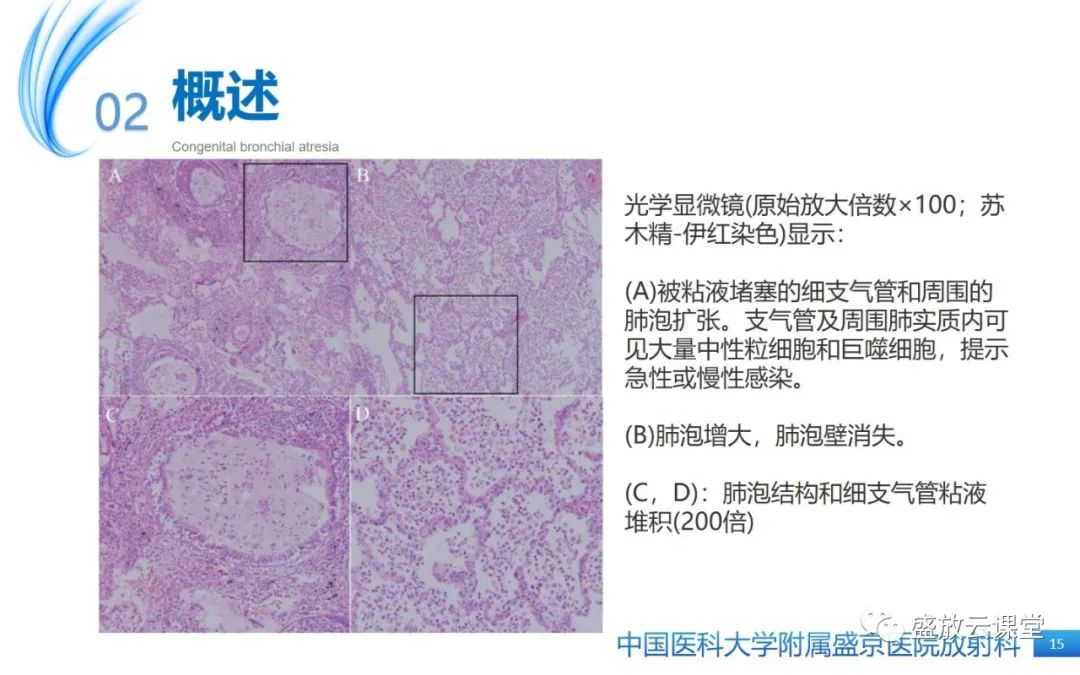 影像PPT - 【PPT】先天性支气管闭锁-14