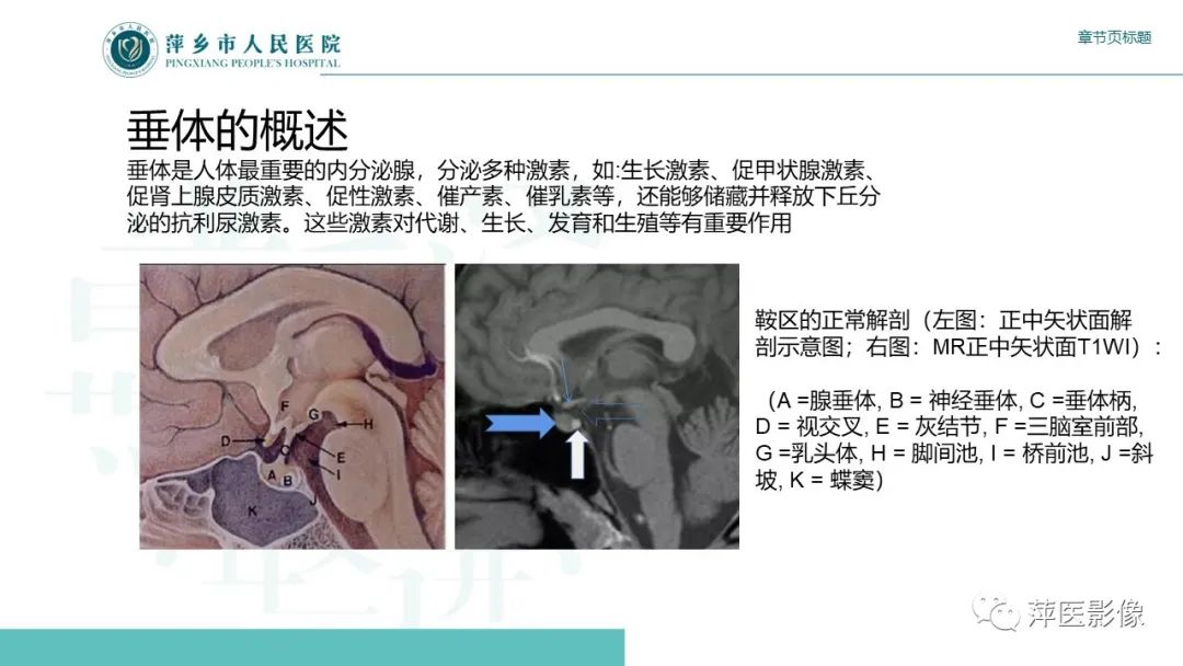影像PPT - 【PPT】垂体常见病变-2