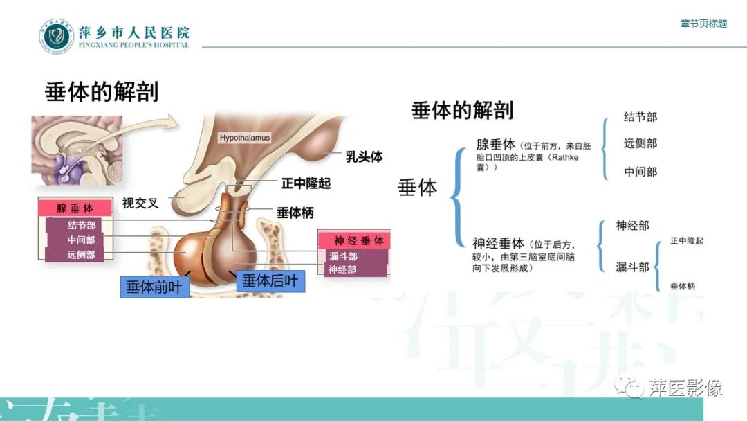影像PPT - 【PPT】垂体常见病变-3