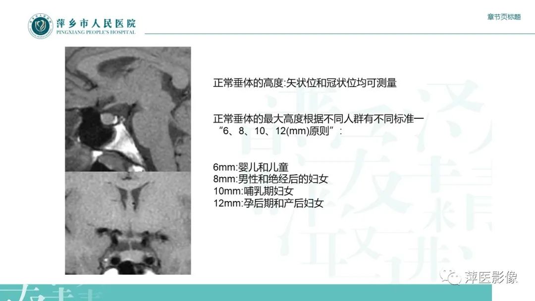 影像PPT - 【PPT】垂体常见病变-5