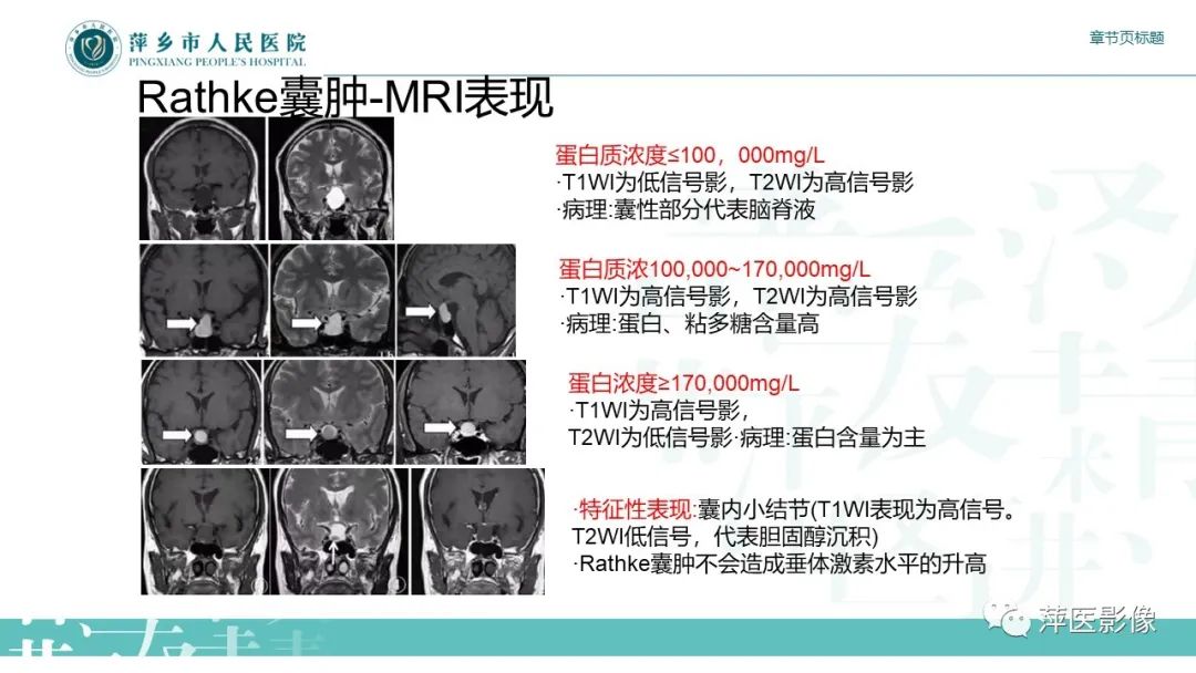 影像PPT - 【PPT】垂体常见病变-9