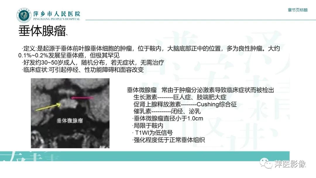 影像PPT - 【PPT】垂体常见病变-12