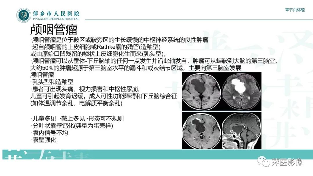 影像PPT - 【PPT】垂体常见病变-16