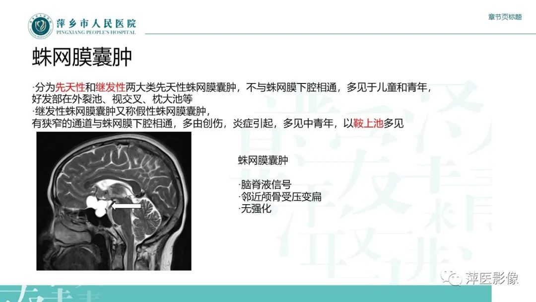 影像PPT - 【PPT】垂体常见病变-20