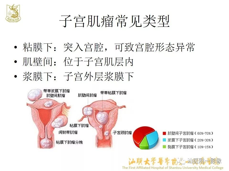 影像PPT - 【PPT】特殊类型子宫平滑肌瘤的影像诊断-2