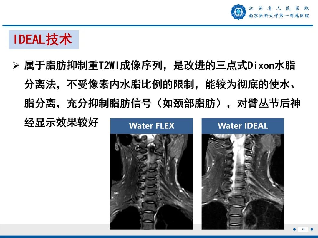 影像PPT - 【PPT】臂丛病变-25