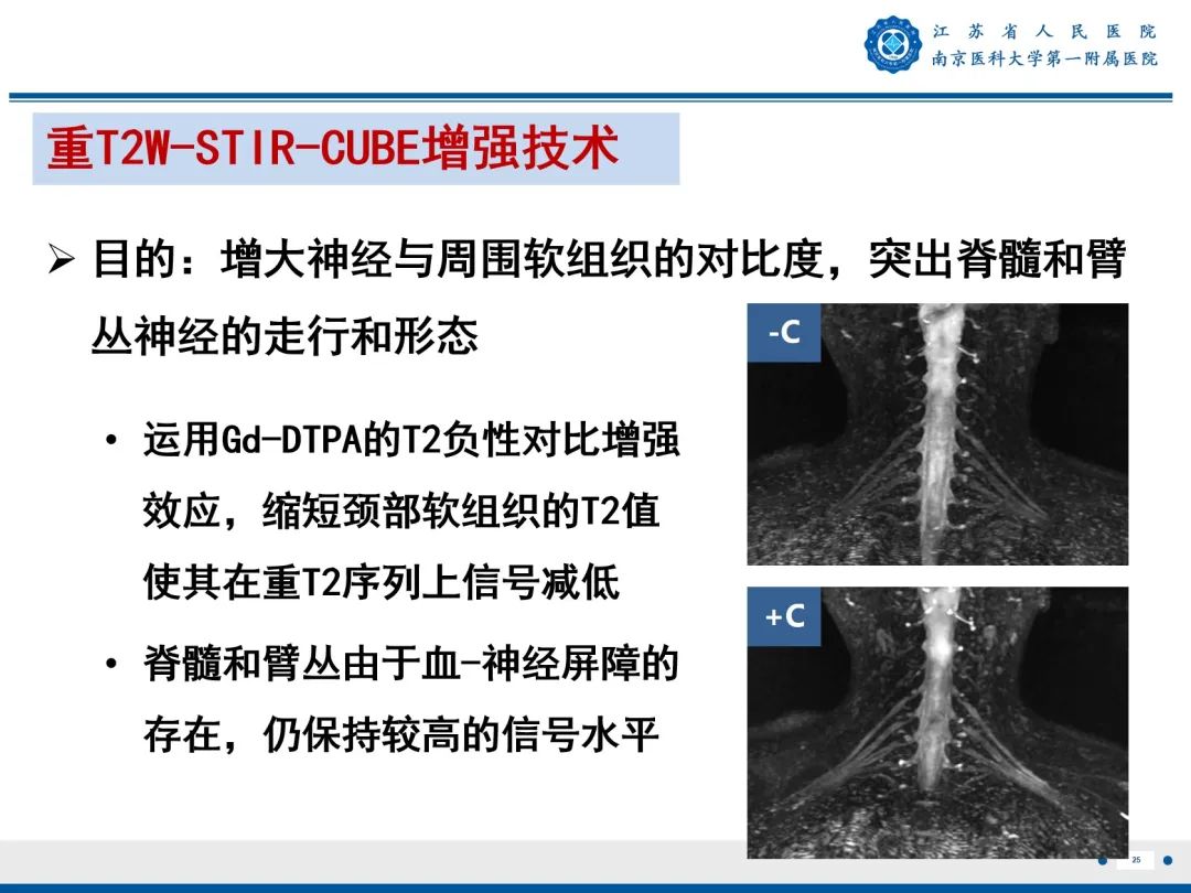 影像PPT - 【PPT】臂丛病变-26