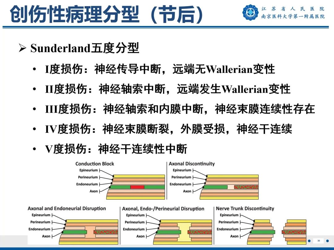 影像PPT - 【PPT】臂丛病变-31