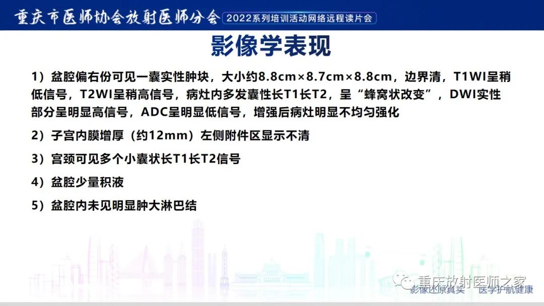 影像PPT - 【病例】卵巢颗粒细胞瘤1例MR影像-8