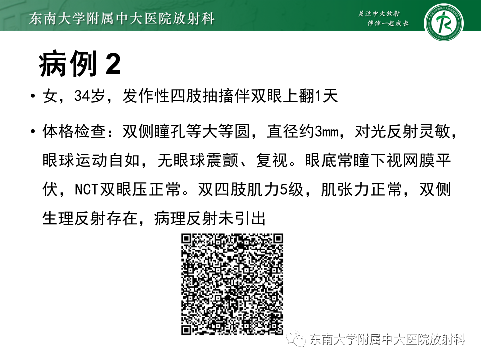 影像PPT - 【PPT】成人颅内T1WI高信号病例随访-4