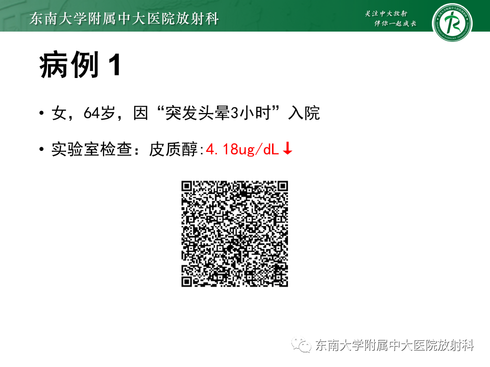 影像PPT - 【PPT】成人颅内T1WI高信号病例随访-1