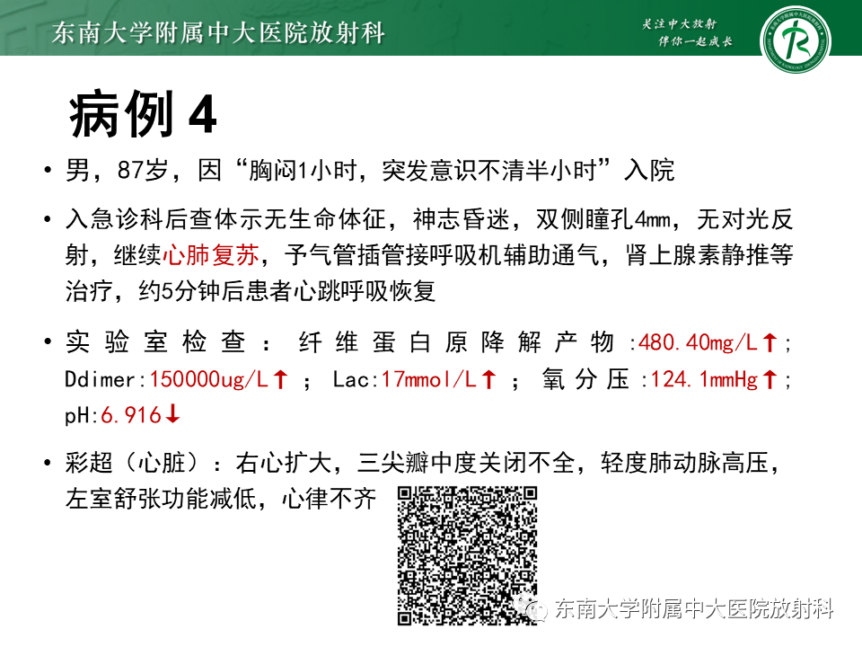 影像PPT - 【PPT】成人颅内T1WI高信号病例随访-8