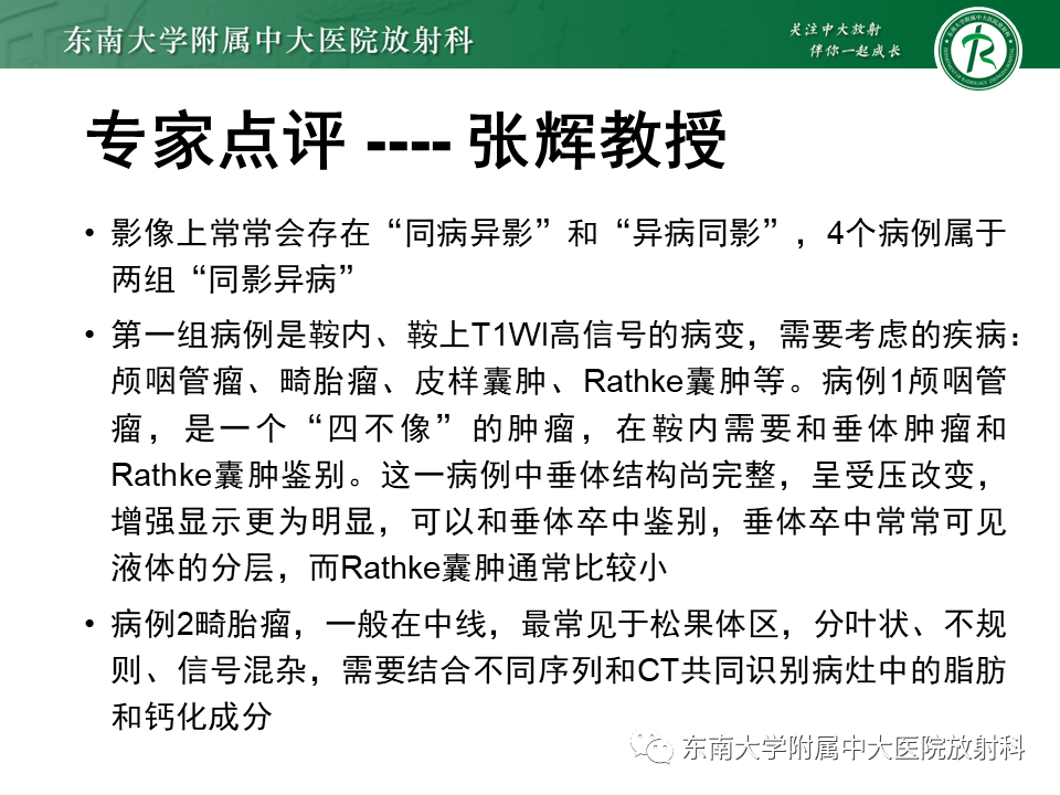 影像PPT - 【PPT】成人颅内T1WI高信号病例随访-16