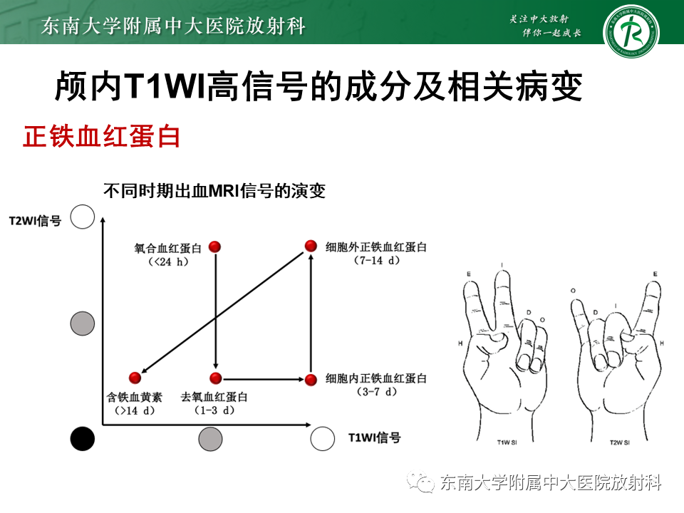 影像PPT - 【PPT】成人颅内T1WI高信号病例随访-24