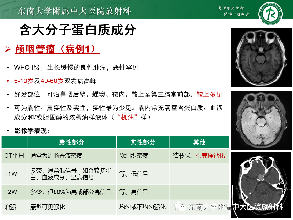 影像PPT - 【PPT】成人颅内T1WI高信号病例随访-27