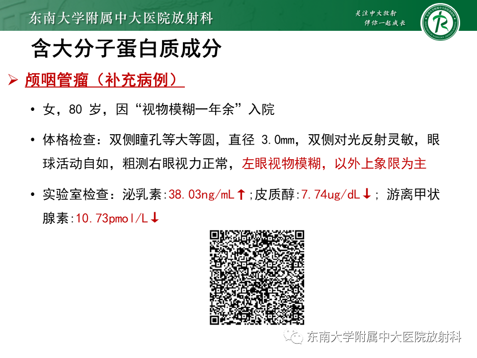 影像PPT - 【PPT】成人颅内T1WI高信号病例随访-29