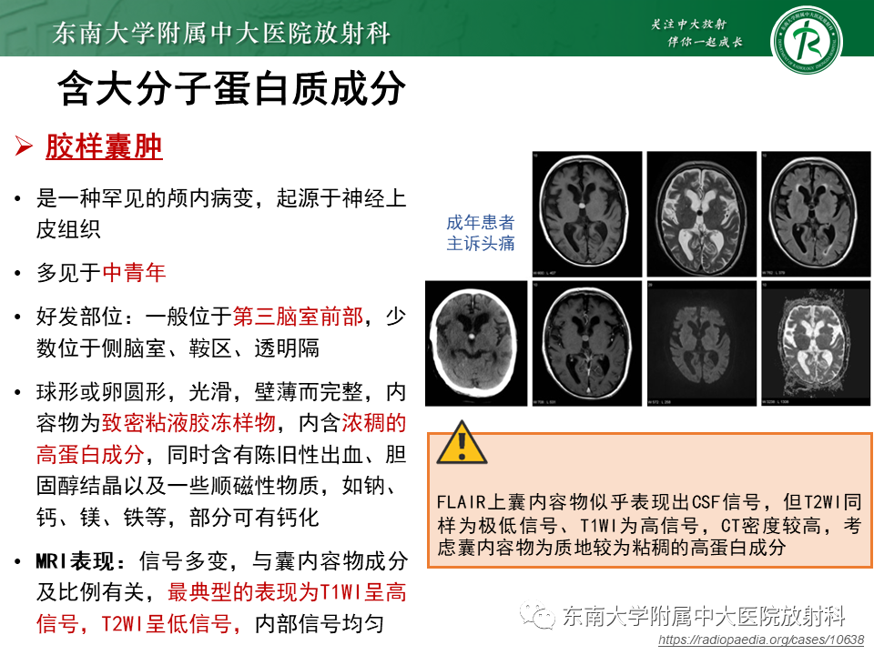 影像PPT - 【PPT】成人颅内T1WI高信号病例随访-33