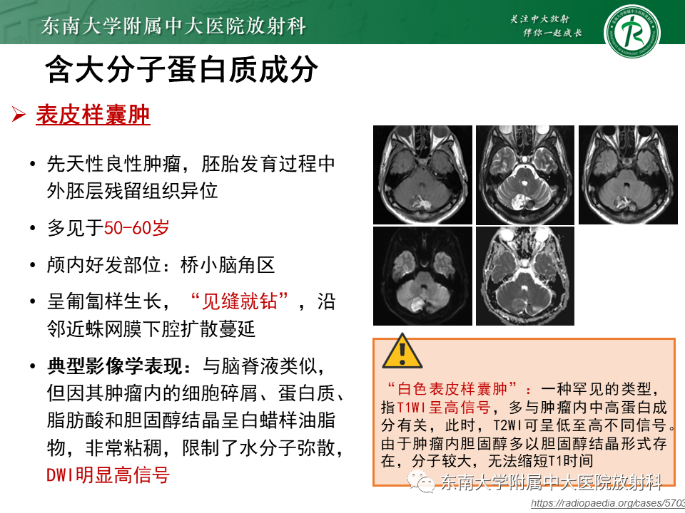 影像PPT - 【PPT】成人颅内T1WI高信号病例随访-34