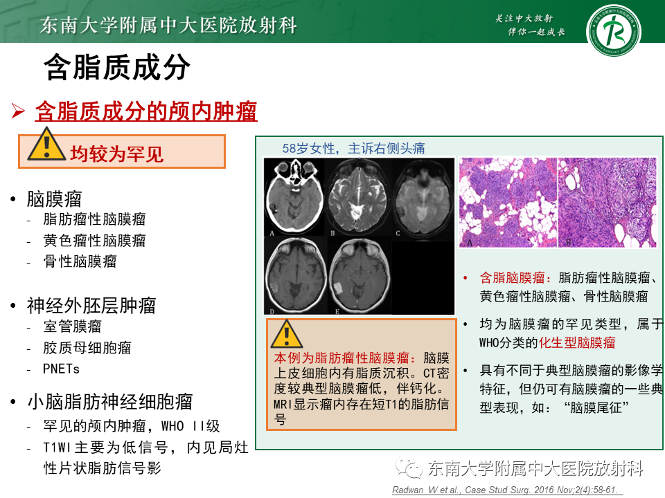 影像PPT - 【PPT】成人颅内T1WI高信号病例随访-40