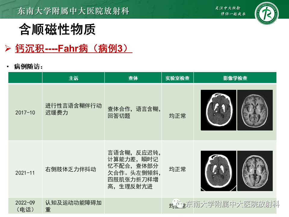 影像PPT - 【PPT】成人颅内T1WI高信号病例随访-43