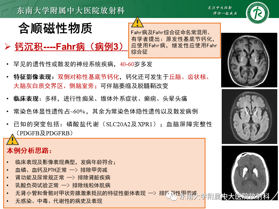 影像PPT - 【PPT】成人颅内T1WI高信号病例随访-44