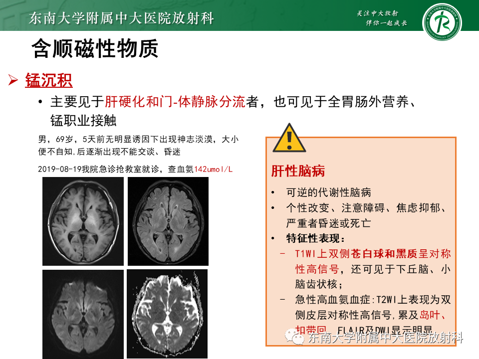 影像PPT - 【PPT】成人颅内T1WI高信号病例随访-46
