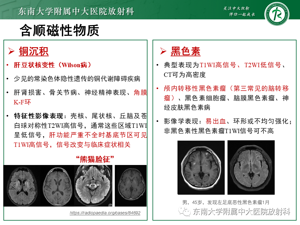 影像PPT - 【PPT】成人颅内T1WI高信号病例随访-47
