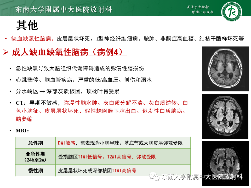 影像PPT - 【PPT】成人颅内T1WI高信号病例随访-49