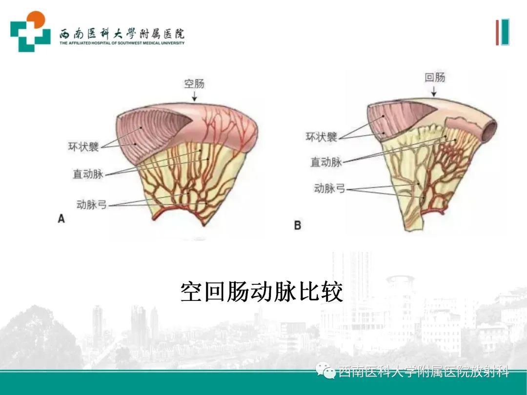 影像PPT - 【PPT】小肠CT检查技术及后处理-5