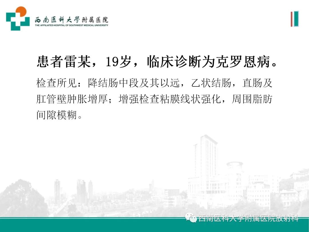影像PPT - 【PPT】小肠CT检查技术及后处理-26