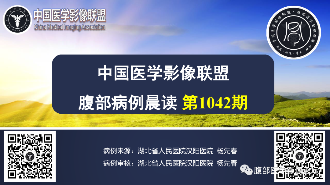 影像PPT - 【病例】膀胱非浸润性低级别乳头状尿路上皮癌1例MR影像-1