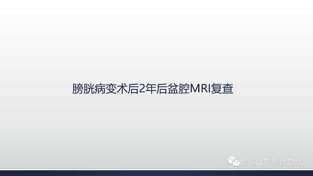 影像PPT - 【病例】膀胱非浸润性低级别乳头状尿路上皮癌1例MR影像-25