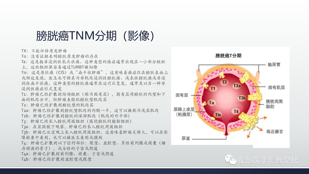 影像PPT - 【病例】膀胱非浸润性低级别乳头状尿路上皮癌1例MR影像-51