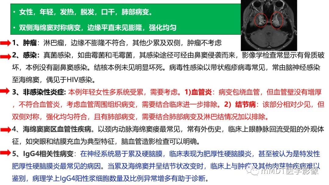 影像PPT - 【PPT】双侧海绵窦结节病—神经结节病综述-18