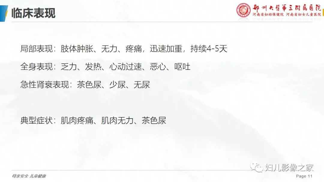 影像PPT - 【病例】横纹肌溶解症1例MR影像-11