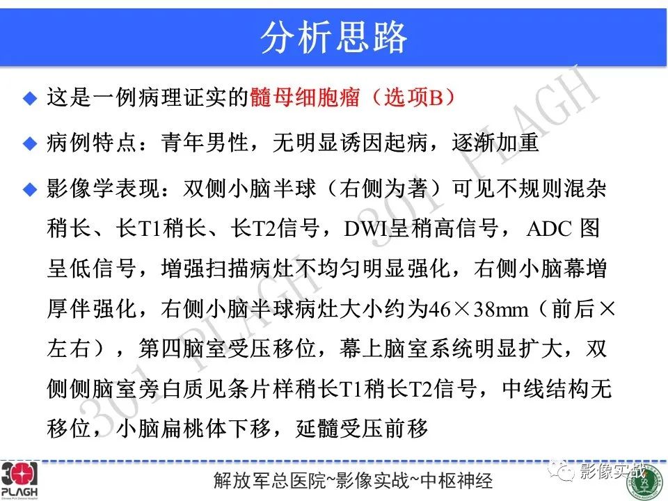 影像PPT - 【病例】成人小脑髓母细胞瘤1例MR影像-13