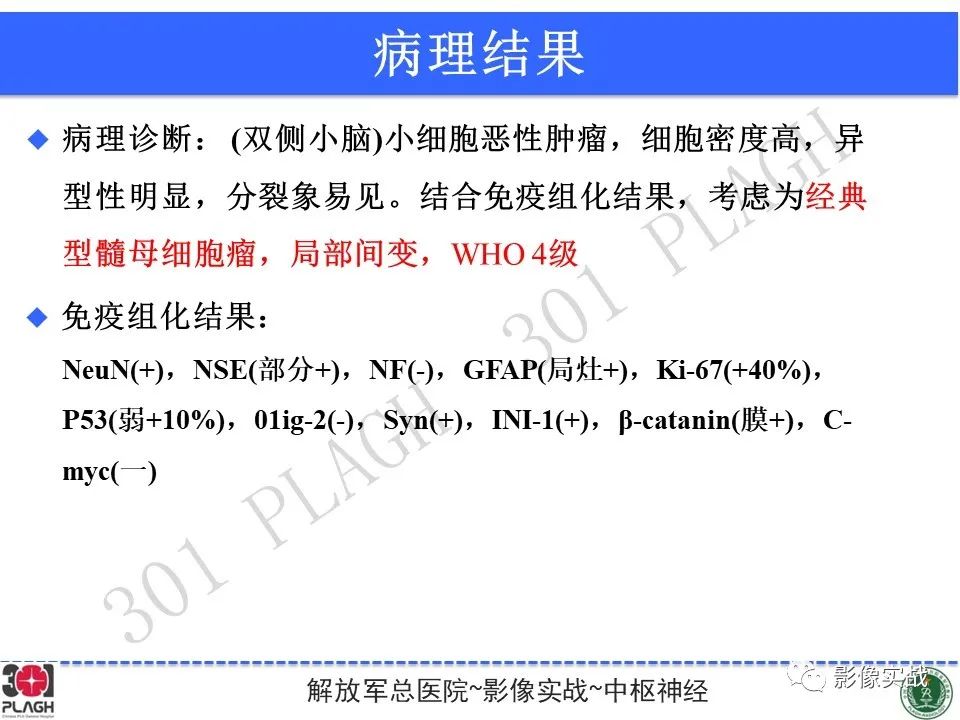 影像PPT - 【病例】成人小脑髓母细胞瘤1例MR影像-19