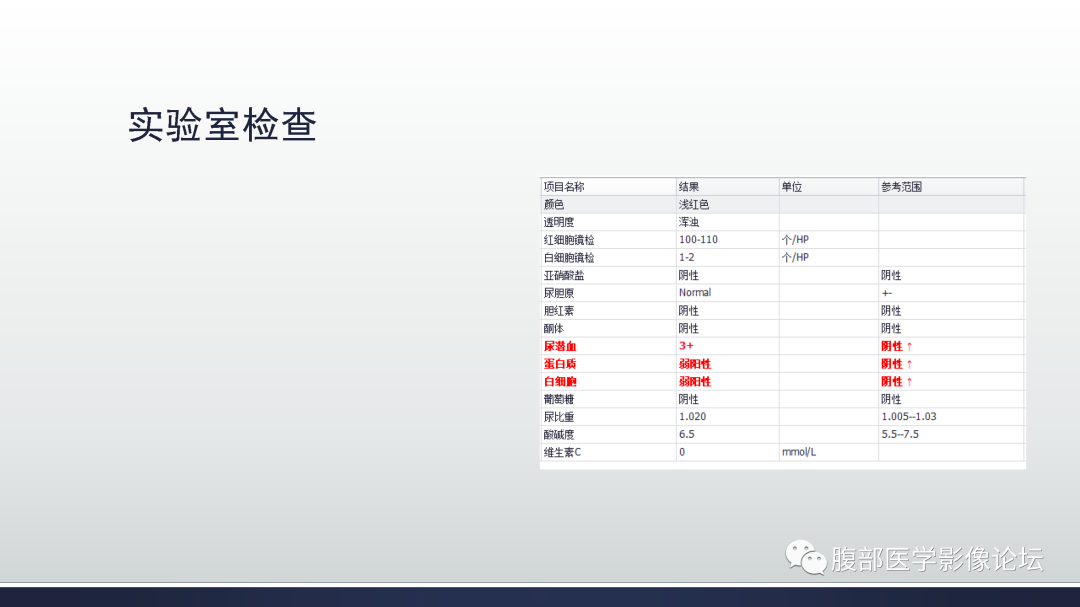 影像PPT - 【病例】卵巢浆液性囊腺瘤1例CT及MR影像-4