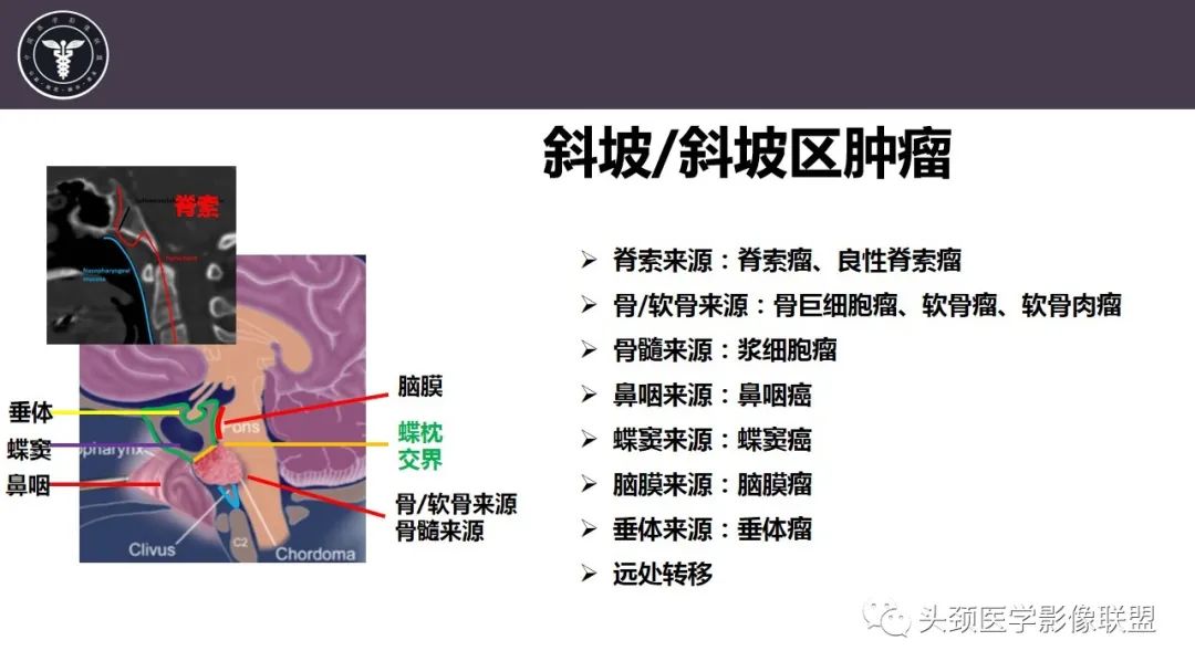 影像PPT - 【病例】斜坡区骨巨细胞瘤 VS 脊索瘤-15