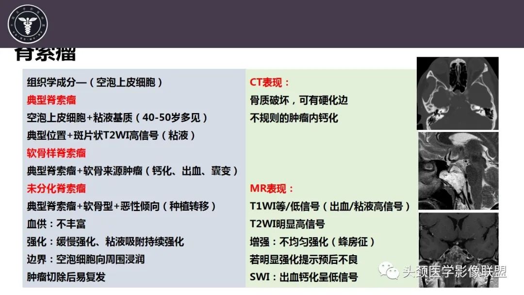 影像PPT - 【病例】斜坡区骨巨细胞瘤 VS 脊索瘤-21