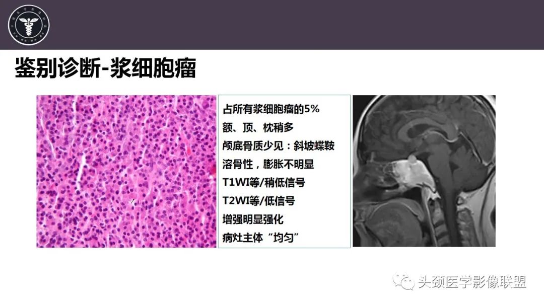 影像PPT - 【病例】斜坡区骨巨细胞瘤 VS 脊索瘤-34