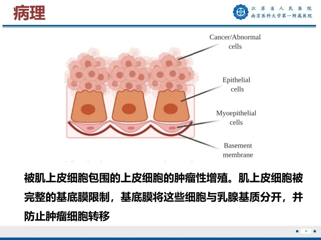 影像PPT - 【PPT】导管原位癌-28