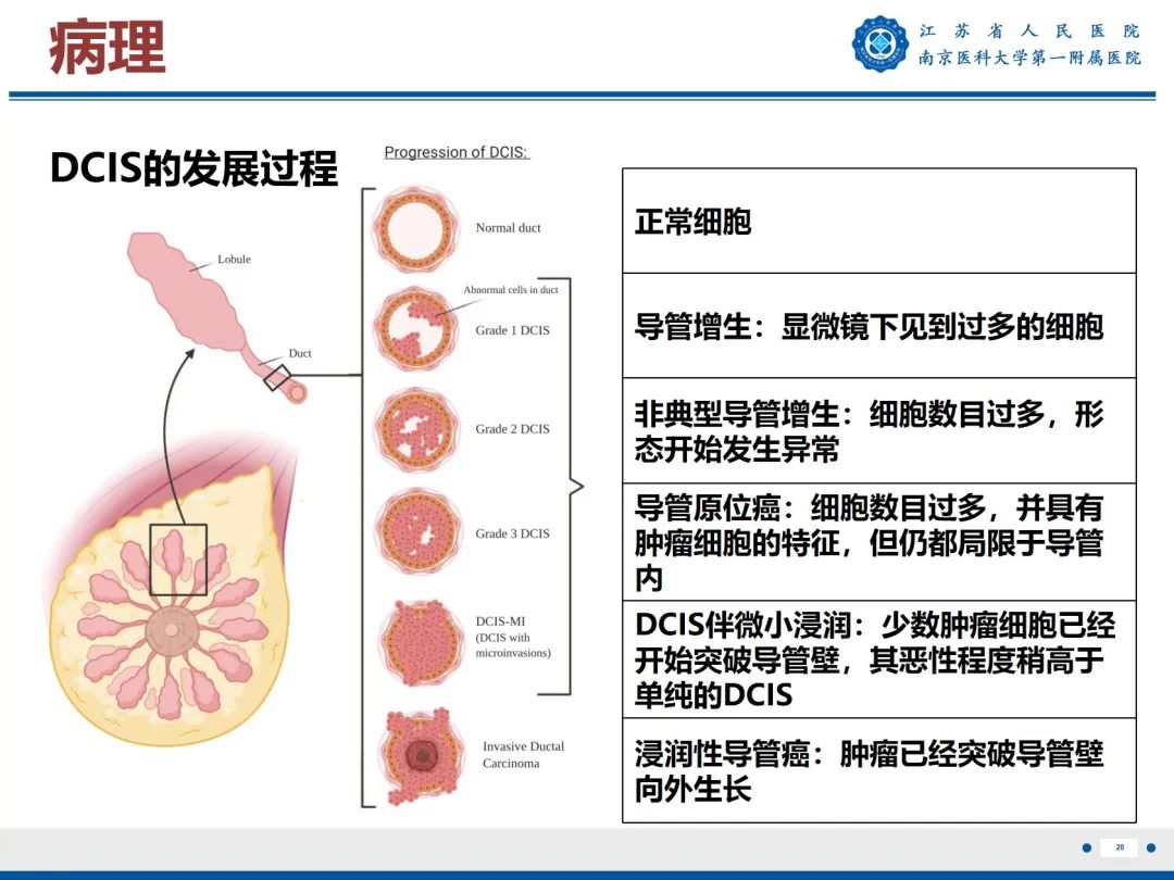 影像PPT - 【PPT】导管原位癌-29