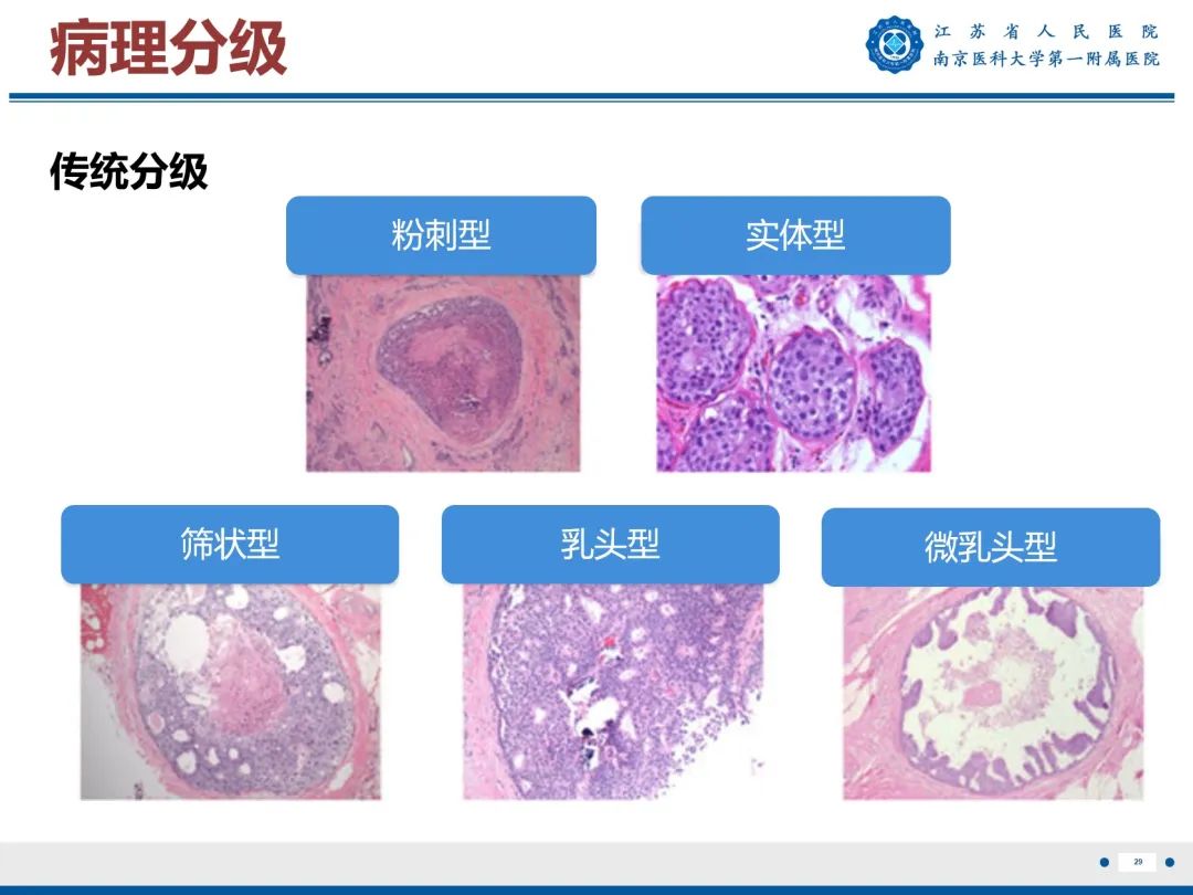 影像PPT - 【PPT】导管原位癌-30